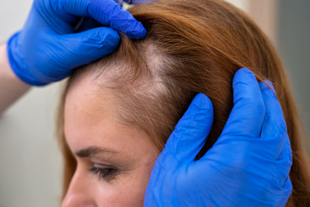 Hair Rejuvenation at Glorious Glow Med Spa in Covington, LA
