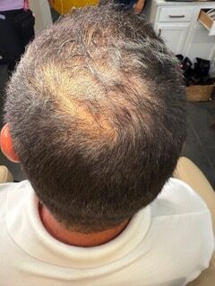 Crown after treatment